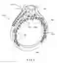 Fig. 06 - Irregular finger ring configuration