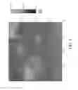 Fig. 06 - Nanoplatelet magnesium hydroxides and methods of preparing same