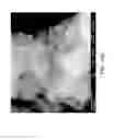Fig. 25 - Nanoplatelet magnesium hydroxides and methods of preparing same