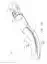 Fig. 11 - Surgical stapling device having supports for a flexible drive mechanism