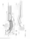 Fig. 12 - Surgical stapling device having supports for a flexible drive mechanism