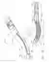 Fig. 15 - Surgical stapling device having supports for a flexible drive mechanism
