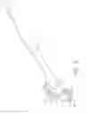Fig. 07 - Surgical stapling device with a curved cutting member