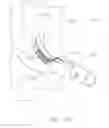 Fig. 09 - Surgical stapler end effector with tapered distal end