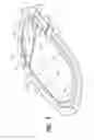 Fig. 04 - Aircraft window erosion shield