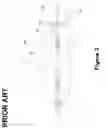 Fig. 04 - Multi-anode radiation detector