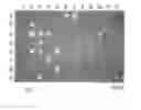 Fig. 02 - METHOD AND DEVICE FOR DETECTING PHOTOSYNTHETIC INHIBITION