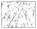 Fig. 01 - Allergen inactivator