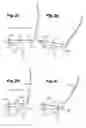 Fig. 10 - Chair