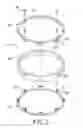 Fig. 04 - Motor magnet fixing device