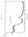 Fig. 04 - CARBIDE DERIVED CARBON, EMITTER FOR COLD CATHODE INCLUDING THE SAME AND ELECTRON EMISSION DEVICE INCLUDING THE EMITTER