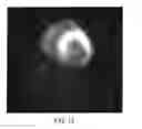 Fig. 10 - System and method for metabolic MR imaging of a hyperpolarized agent