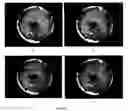 Fig. 17 - Identifying spurious regions in a video frame