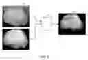 Fig. 06 - System for early detection of dental caries