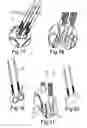 Fig. 07 - Device for storing and applying liquid and/or pasty substances