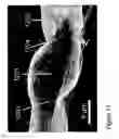 Fig. 13 - Fabrication of twisted and non-twisted nanofiber yarns