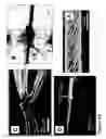 Fig. 70 - Fabrication of twisted and non-twisted nanofiber yarns