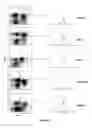 Fig. 02 - Methods of Treating Graft Versus Host Disease