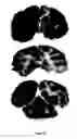 Fig. 41 - Methods for diagnosing and treating CNS disorders by trans-blood-brain barrier delivery of protein compositions
