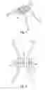 Fig. 02 - Orthodontic expansion screw