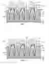 Fig. 02 - DENTAL IMPLANT KIT AND METHOD OF USING SAME