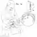 Fig. 02 - Methods and apparatus for dental implantation