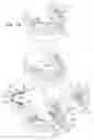 Fig. 07 - Methods and apparatus for dental implantation