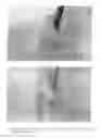 Fig. 04 - Translucent, isotropic endodontic post