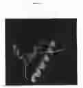 Fig. 09 - Detection of conformationally altered proteins and prions