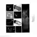 Fig. 02 - Method of obtaining a population of human haemopoietic stem cells