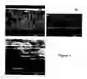 Fig. 02 - Nanostructured metal-polyaniline composites