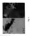 Fig. 02 - Inhibition of invasive remodelling