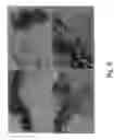 Fig. 06 - Inhibition of invasive remodelling