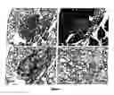 Fig. 05 - Composition and method for treating diabetes