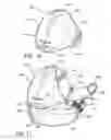 Fig. 15 - Method and apparatus for deriving and reporting a physiological status of an individual utilizing physiological and contextual parameters