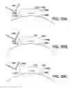 Fig. 34 - Method and apparatus for deriving and reporting a physiological status of an individual utilizing physiological and contextual parameters
