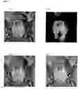 Fig. 07 - Method and system for lymph node detection using multiple MR sequences