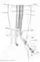 Fig. 01 - Devices, systems, and methods for peripheral arteriovenous fistula creation