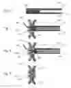 Fig. 07 - Devices, systems, and methods for peripheral arteriovenous fistula creation