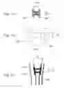 Fig. 09 - Devices, systems, and methods for peripheral arteriovenous fistula creation