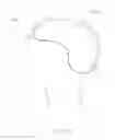 Fig. 05 - Method and devices for treatment of neurological stroke