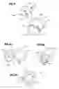 Fig. 06 - TAMPER EVIDENT CAP FOR A DRUG DELIVERY DEVICE