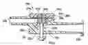 Fig. 01 - Patency Check Compatible Check Valve And Fluid Delivery System Including The Patency Check Compatible Check Valve