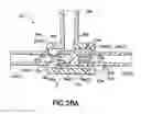 Fig. 22 - Patency Check Compatible Check Valve And Fluid Delivery System Including The Patency Check Compatible Check Valve