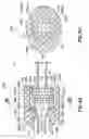 Fig. 43 - Patency Check Compatible Check Valve And Fluid Delivery System Including The Patency Check Compatible Check Valve