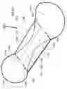 Fig. 06 - Article, Such As Disposable Absorbent Article, Maintaining A Concave Cup-Like Shape During Use