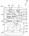 Fig. 01 - Insulin pump having correction factors