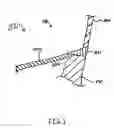 Fig. 03 - Methods and devices for catheter advancement and delivery of substances therethrough