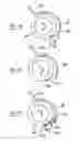 Fig. 08 - Methods and devices for catheter advancement and delivery of substances therethrough