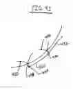 Fig. 09 - Methods and devices for catheter advancement and delivery of substances therethrough